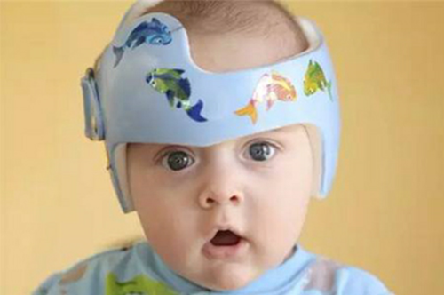 婴儿头盔改善头骨形状