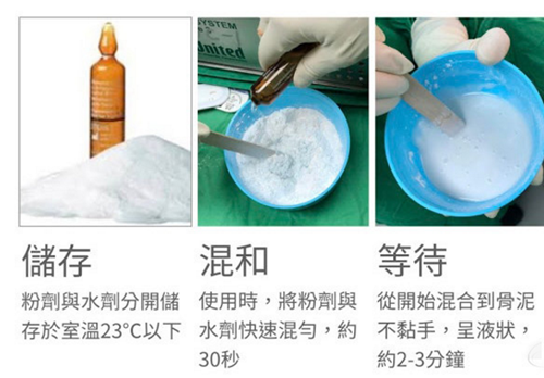 韩国雕刻整形医院骨水泥填充手术