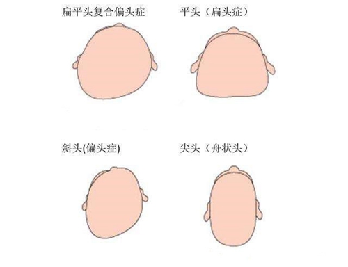 头部有缺陷的几种情况